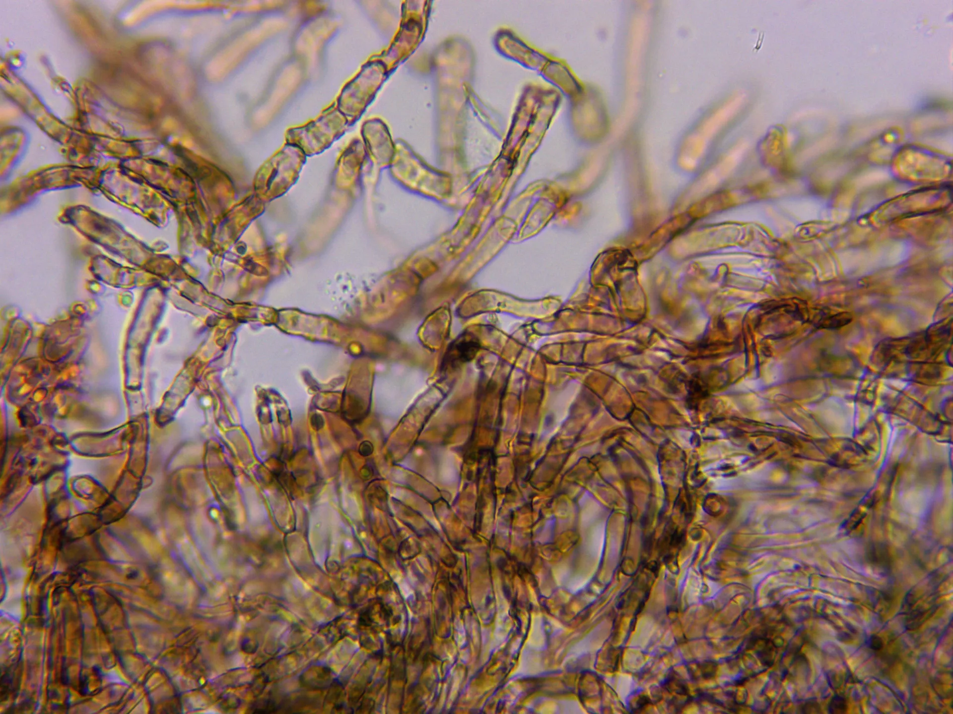 Microscopía de Leucopaxillus gentianeus - 15 - Cutícula x 400